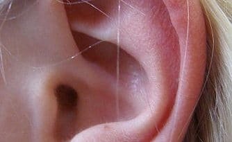 dry skin behind ear
